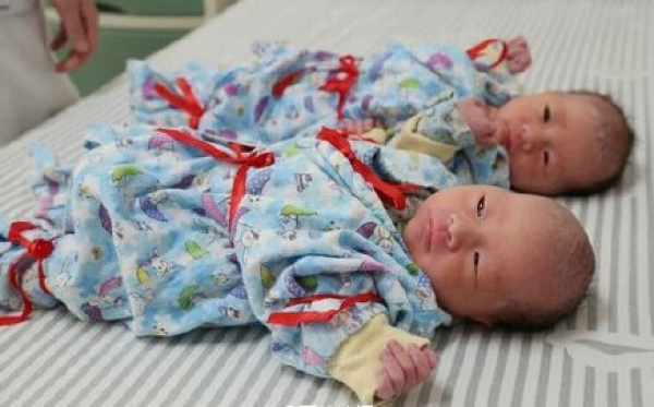 二胎母亲诞三胞胎 通过自然受孕产下概率极低