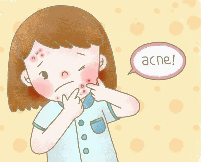 解析夏天易长痘痘的原因