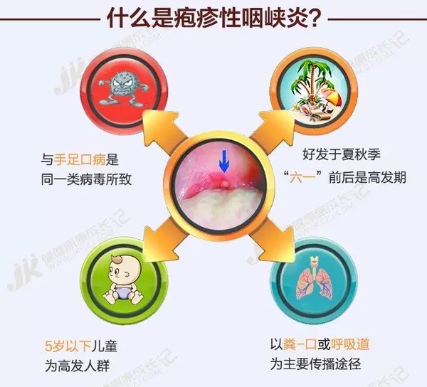最近好多孩子突然发烧,喉咙通红,嘴里全是疱疹,咋回事